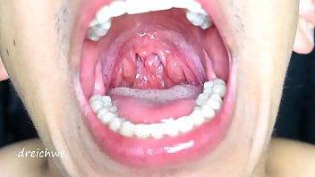 Exciting uvula