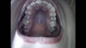 Endoscopic yawning