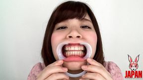 Discovering Hikaru's Dental Delights