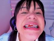 Lila Jordan swallows a lot gummy bears