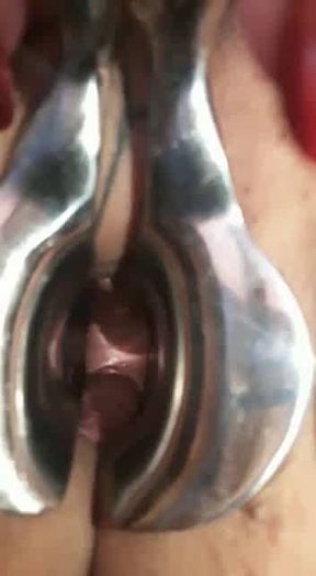ROMANIAN WIFE CRISTINA CAVARGIC VAGYNAL EXAM WITH SPECULUM CLOSE UP VIEW