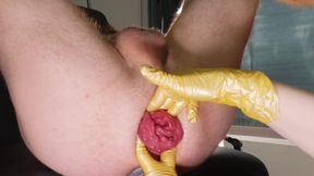Dominatrix Causes Extreme Rosebud and Fat Ass Lips