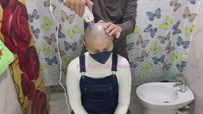IPL hair removal on Bald Head "SECOND SESSION"