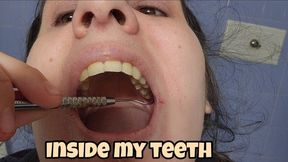 Dental mirror and hook teeth inspection fetish, exploring my mouth and showing every tooth close-up