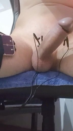E-stim Hfo