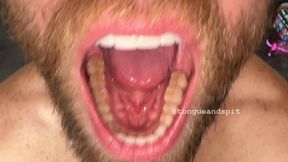 Andrew Teeth Bottom Molars and Retainer Part17 Video1 - MP4