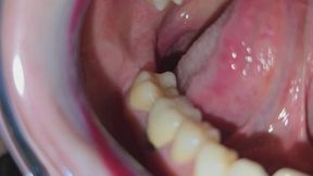 Tour of my mouth with retractor 8K