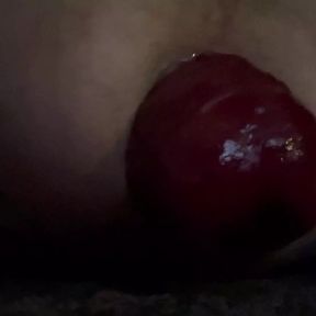 Anal prolapse in and out pratice