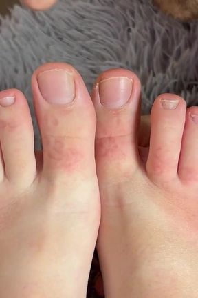 Hard Feet Biting