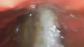 Kimmy's Morning Coffee (STOMACH ENDOSCOPE FOOTAGE)