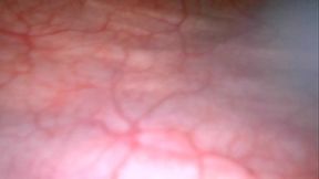 Inside my bladder full of piss.