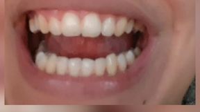 Admire the imperfections of our teeth