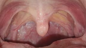 My uvula, your temptation.