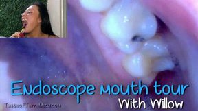 Endoscope Mouth Tour - Willow Lansky - HD 720 MP4