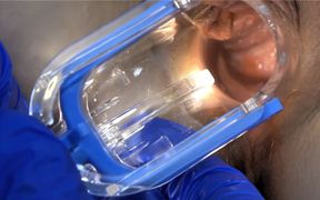 Comp Speculum Edit! Anal &amp; Pussy Speculum Close Ups!