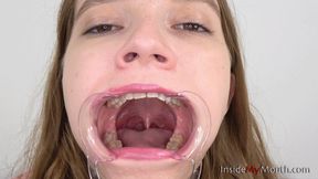 Inside My Mouth - Lola - Mouth retractor clip! (4K quality)
