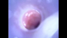 View Inside Cock While Jerking and Cumshot ( Camera Inside Dick )