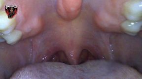 Testing New Endoscope- Short Mouth Tour