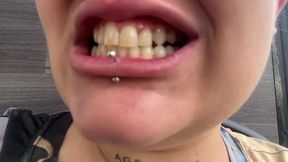 teeth check-up on the bus