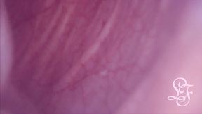 fucked in my pussy + camera in my bladder = crazy bulge!