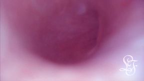 fucked in my pussy + camera in my bladder = crazy bulge!