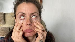 silly faces with eye crossing avi