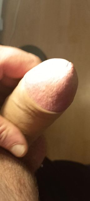 Penis