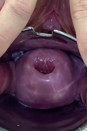 Glass Dildo Cervix Penetration