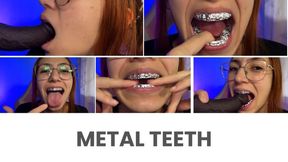 Metal Teeth