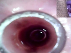 Lesbians Extreme Cervix Play and Peehole Fucking Penis Dildo