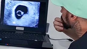 Gynecologist ravages the cuckold wife during ultrasound exam