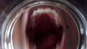 Woke Up Trapped in a Jar