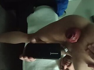 Watersports and Prolapse