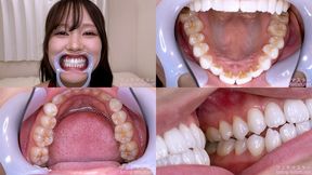 Serina Usui - Watching Inside mouth of Japanese cute girl - MOV