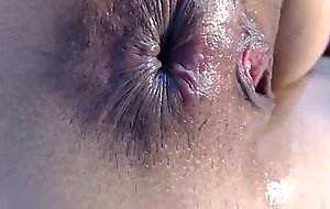 The best and her prolapse