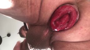 He Spreads His Thighs to Reveal His Anal Prolapse and His Sperm
