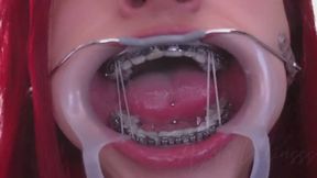 "Stainless Steel Smile"