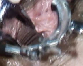 Horny German woman gets her moist holes checked by a doctor and a nurse