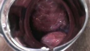 ”Hot Preggy Beauty with male nurses & doc love to suck cocks.”