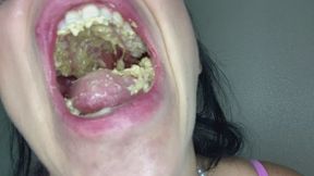 Teeth vs. Wafer Candy: Mega Crunch