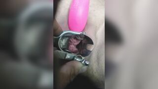 Close up Speculum and Internal Veiw of Squirting