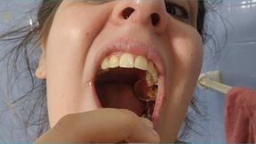 Exploring My Cavities in Extreme Close-Up - Deep Mouth View