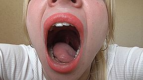 Wide yawn! MP4