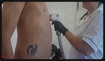 Permanent Laser Hair Removal with Happy Ending - BabyLuna939