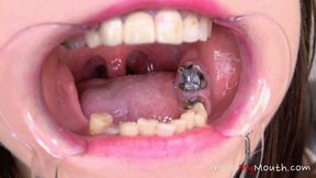 Inside My Mouth - Chanel Kiss - mouth examination and exploration part 2 (HD)
