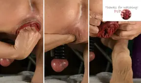 Sellffist - The Next Level - self fist my horny ass - deep rough anal fisting - Prolape & Rosebud - PART 1