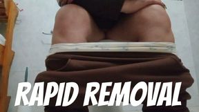 Rapid removal