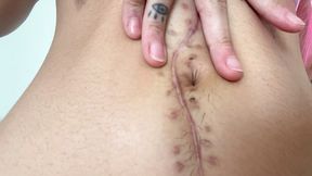 nali marie belly button fetish huge surgery scar fetish
