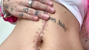 nali marie belly button fetish huge surgery scar fetish