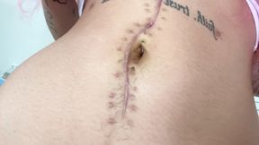 nali marie belly button fetish huge surgery scar fetish